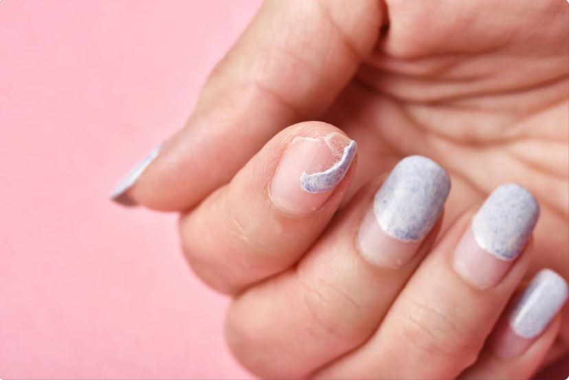 matrice-ongle-atteinte
